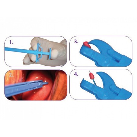 Bioptické kleště gyn&push 21,5 cm – sterilní – balení 25 ks