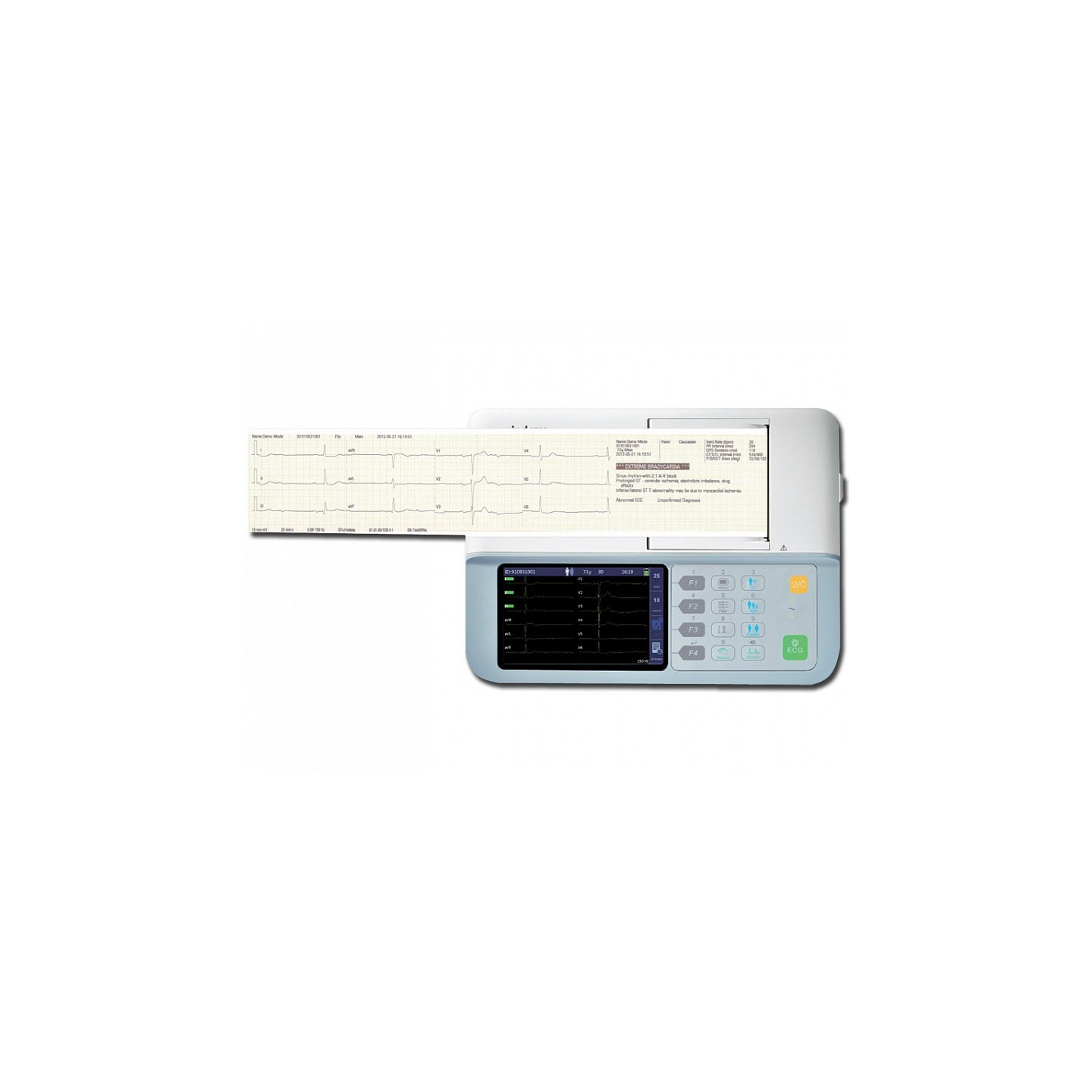 Ecg mindray beneheart r3