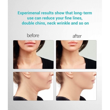 Anteaneck masažer za lice i vrat protiv bora za učvršćivanje kože