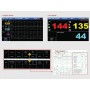 Monitorul Fetal FC1400