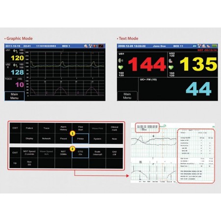 Twin FC1400 Fetal Monitor