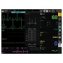 Gima bm3 pro monitor - spo2 + ecg + nibp + temp + ill