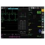 Monitor Gima Bm3 Pro — Spo2 + EKG + Nibp + Temp + Oddech