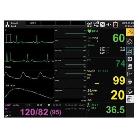 Gima bm3 pro monitor - spo2 + ekg + nibp + temp + resp