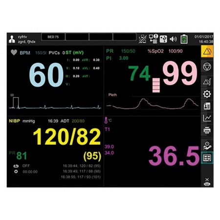 Monitor gima bm3 pro - spo2 + ekg + nibp + temp + resp