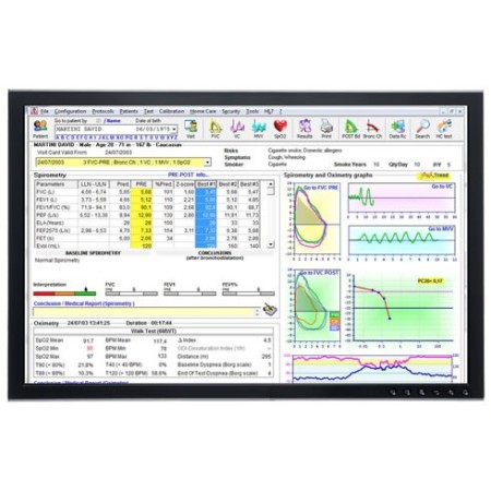 Mir spirolab spirometr s tiskárnou, oxymetrem a softwarem mir spiro