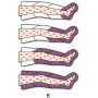 Presoterapia Presoterapia Ondas Intensas Presomasaje Dos Piernas (con 2 polainas)