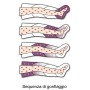 Presoterapia Presoterapia Mesis Plus + masaż z 2 legginsami + Zestaw Slim Body + Bransoletka