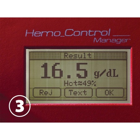 Kontrola hemo