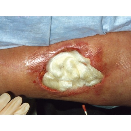 Tegaderm 3m alginate 10x10 cm - conf. 10 pz.