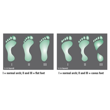 Nuevo podoscopio led lux