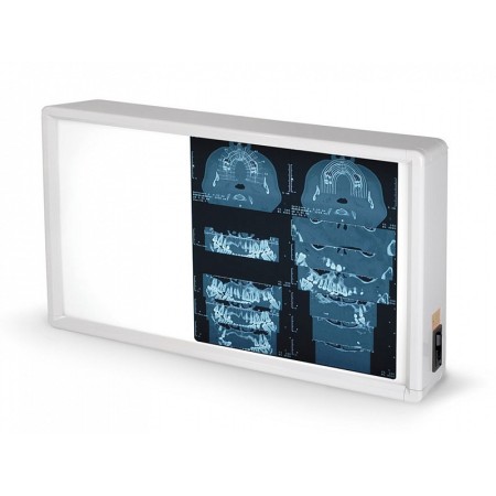 Negatief scoop 38x62 cm