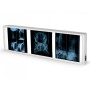 Drievoudige röntgenfoto 38 x 122 cm
