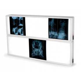 RTG rentgen 2x3 panely 76 x 122 cm
