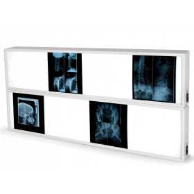 Röntgenfoto 2x4 panelen 76 x 153 cm