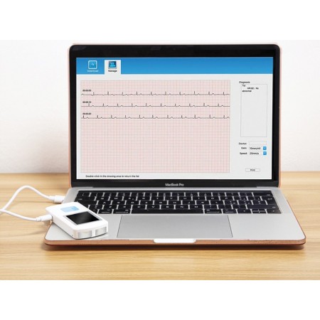 Pm-10 bluetooth kézi ekg