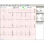 electrocardiógrafo inalámbrico PC-ECG EUROECG BT12