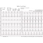 Électrocardiographe PC-ECG sans fil EUROECG BT12