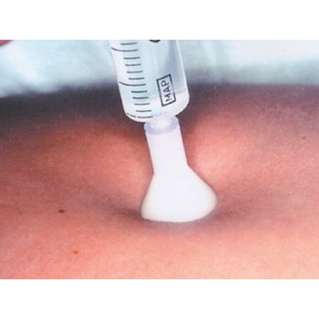 Terapia de inyección cutánea s.i.t. 31g 0,26x2,5mm - blanco - paquete 25 piezas.