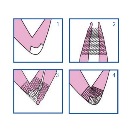 Elastic tubular mesh - size c for arm and shoulder - latex free