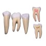 Jeu de 3 dents (canine, molaire, incisive)