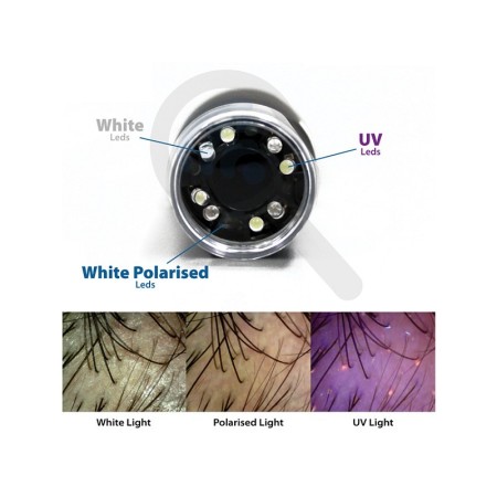 Gepolariseerde led dermatoscoop + uv + witte microfoon wi-fi & usb met software