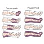 Estetická presoterapie JoySense 2.0 se 2 legínami a estetickou sadou na břicho