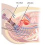 Elektrostimulátor perineální inkontinence Beac IntelliSTIM BE-28UG