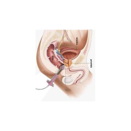 Beac intellistim be-28ug perineal elektrostimulator til inkontinens