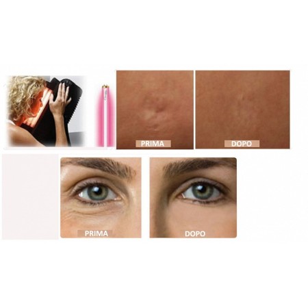 Tri-facial lamp collagen 12 tubes for collagen photostimulation