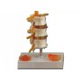Herniapathologiemodel