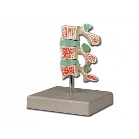 Modelul de osteoporoză