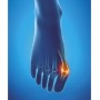 Epitact - Hallux Valgus Protection - Small (36-38)