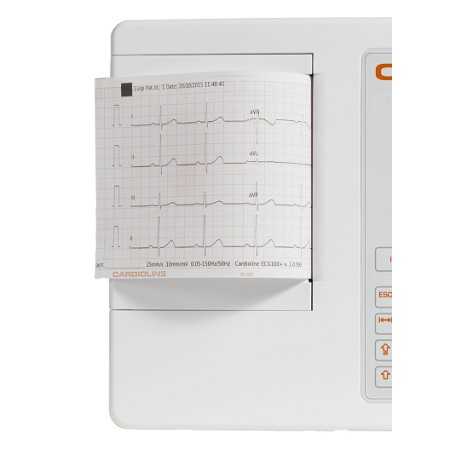 Original z-fold 100 CARDIOLINE ECG pack, 100x150mm x180-10 pcs