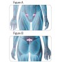 Patch Fit Therapy Lady - 2 kits de 3 patchs