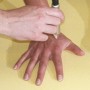 Terapia laserowa physiolaser 1000
