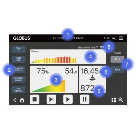 Globus diacare 7000, tecar terapia