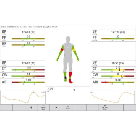 Vasoscreen 2000 - system for the evaluation of the ankle-brachial index (abi)