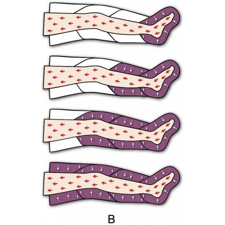 Pressotherapie pressomassage ekò advance ausrüstung (2 leggings + slim body kit)