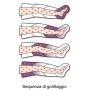 Presoterapie PressoMassage Mesis Plus+ BASIC vybavení (2 legíny)