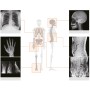 Zestaw REMEX KA6 X-RAY składający się z kamery, detektora 43x43cm oraz laptopa z oprogramowaniem