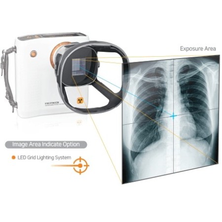 Remex ka6 x-ray avec collimateur