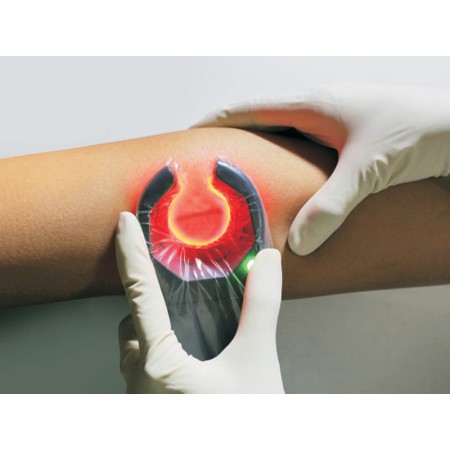 Veinspy přenosný detektor žil