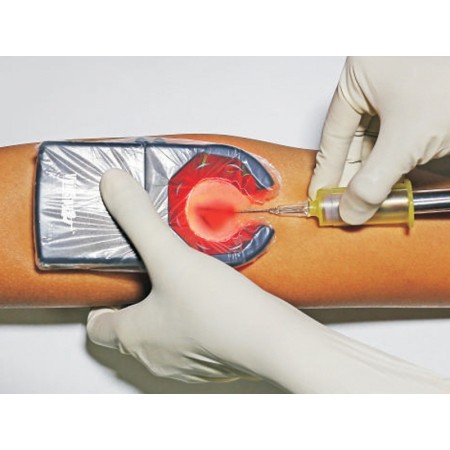 Détecteur de veines portable veinspy