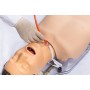 Medical Simulator for Assisted Feeding Management, PEG, Nasogastric Tube and Tracheostomy