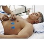 Ambu blaue Sensorelektroden an - 4 mm - Pack 1200 Stk.