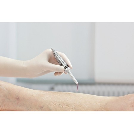 Askina calgitrol calciumalginat und ionische silberpaste 15 g - 5 stück.