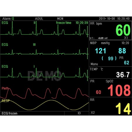 Pc-3000 multi-parameter monitor
