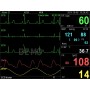 PC-3000 Multiparametrový monitor