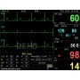 Pc-3000 multiparametermonitor